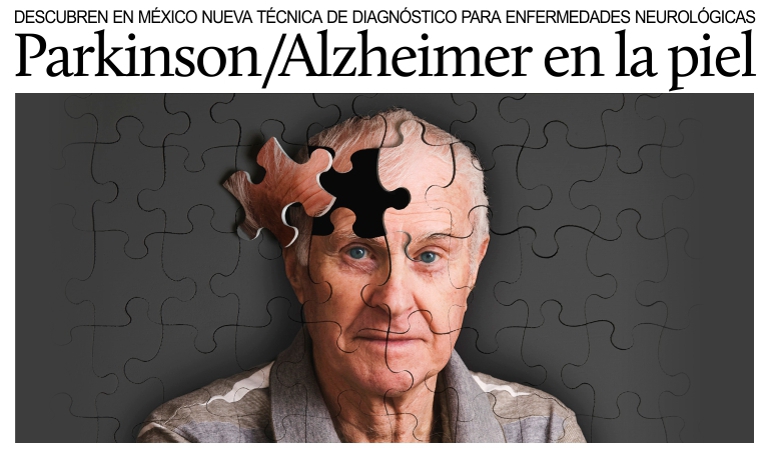 Descubren en Mxico nueva tcnica de diagnstico para las enfermedades de Parkinson y Alzheimer