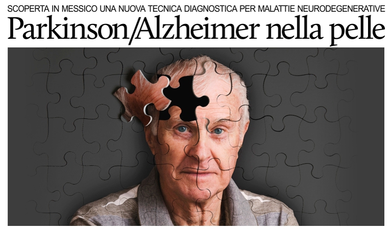 Scoperta in Messico una nuova tecnica diagnostica per le malattie di Parkinson e Alzheimer